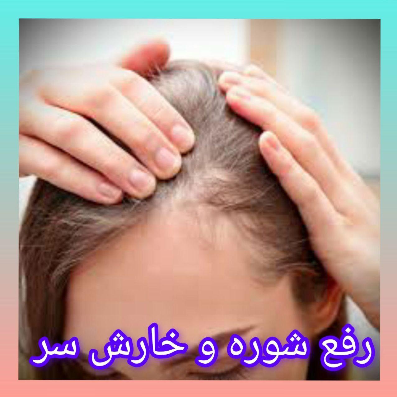 چطوری خارش و شوره سر رو با سرکه سیب درمان کنم؟