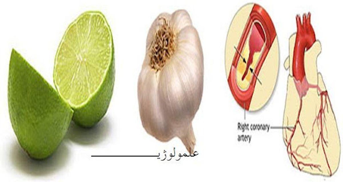 اگر رگ های قلبتان گرفته با این معجون "سیر و لیمو" فورا رگهای قلب تان را باز کنید +دستور تهیه